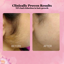 Load image into Gallery viewer, Eternaglow™ Cyperus Rotundus Oil for Hair Reduction