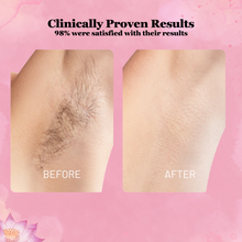 Load image into Gallery viewer, Eternaglow™ Cyperus Rotundus Oil for Hair Reduction
